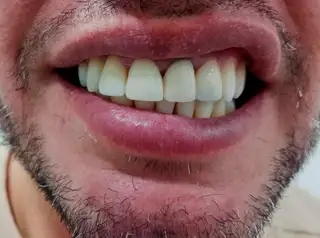  — paso 2 de 3 · White Smile Odontología, Chapinero, Bogotá