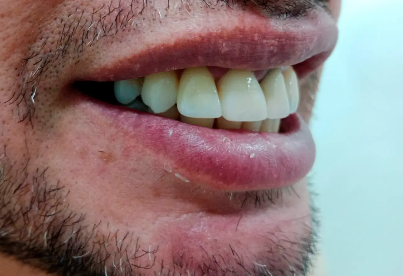  — paso 1 de 3 · White Smile Odontología, Chapinero, Bogotá