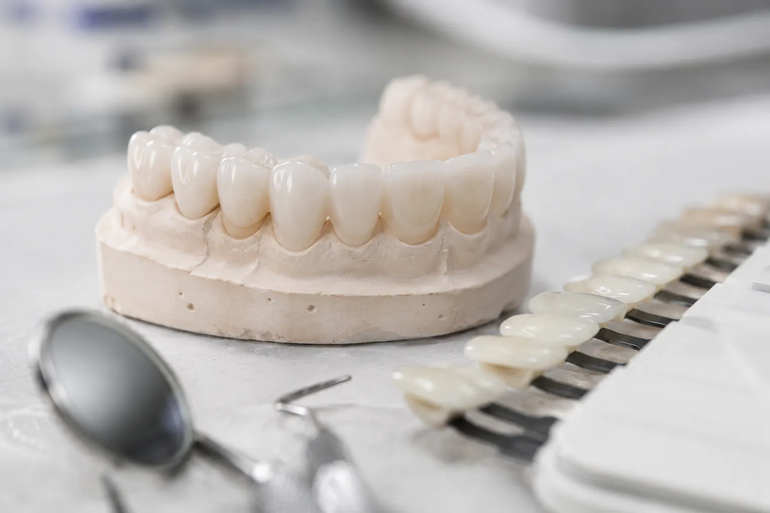 Dientes anteriores superiores con textura de esmalte, translucidez incisal y asimetría natural, tras diseño de sonrisa en White Smile Odontología, Bogotá.